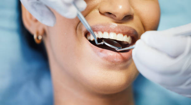Best Emergency Dentist for Lost Fillings or Crowns in Cloverdale, IN