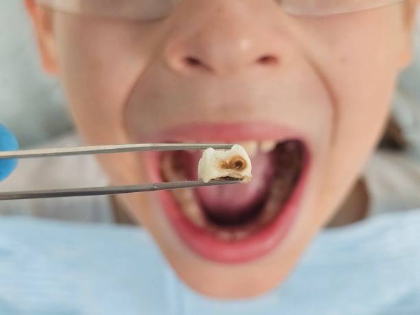 Best Mobile Emergency Dentist in Cloverdale, IN