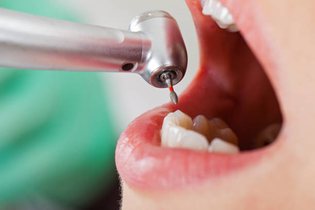 Best Urgent Dental Care for Toothache in Cloverdale, IN